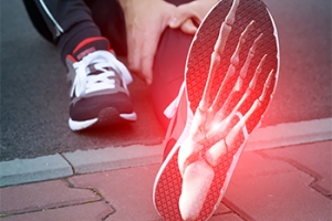 Causes of Foot Pain From Running