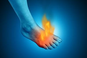 Common Reasons for Burning Foot Pain