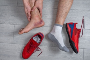 Causes and Risks of Ankle Sprains in Athletes